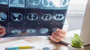 Lung Cysts and Infections (Bronchiectasis, Hydatid Cyst)