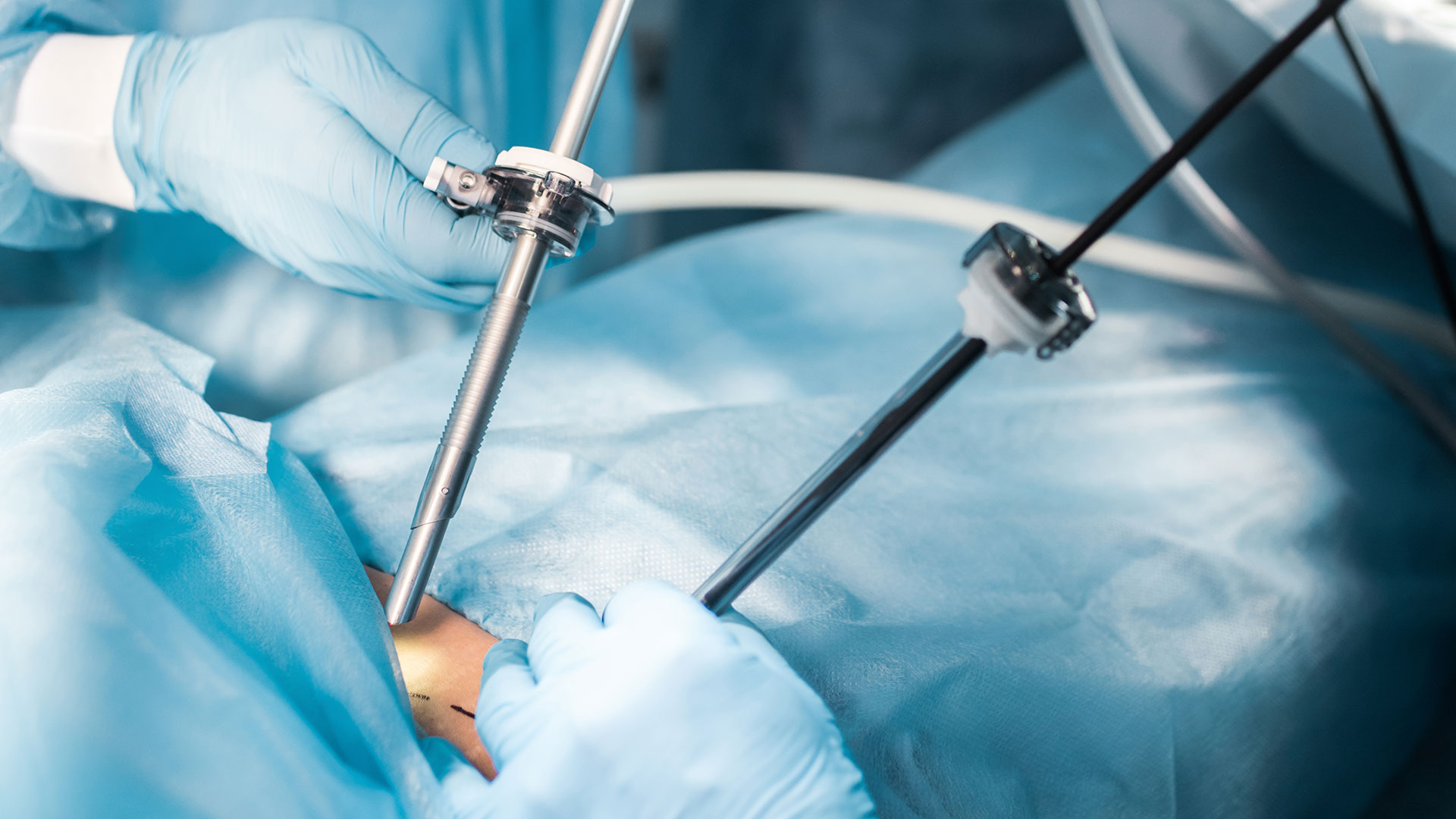 Akciğer Metastaz Cerrahisi (Metastazektomi)