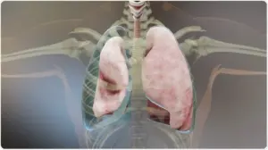 Хирургия лёгких и плевральной (мембранной) хирургии