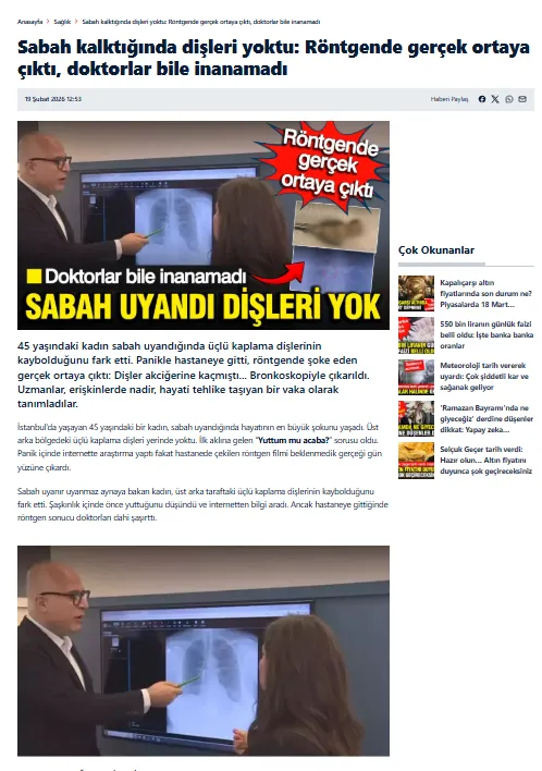 Sabah kalktığında dişleri yoktu: Röntgende gerçek ortaya çıktı, doktorlar bile inanamadı