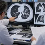 10 Bronsektazi Ameliyati Kimlere Yapilir